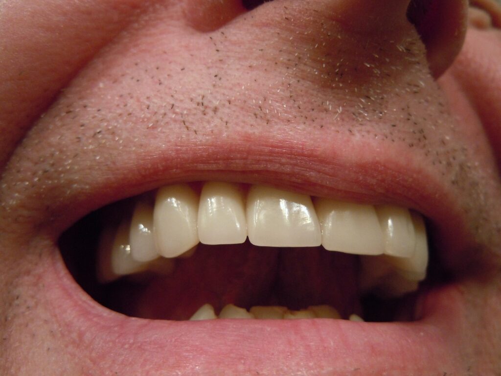 Teeth Straightening Bristol